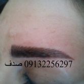 میکروپیگمنتیشن:هاشور صدف اصفهان