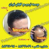 ترمیم مو به روش انحصاری ، های فیکس آلمان (گلهای تهران )